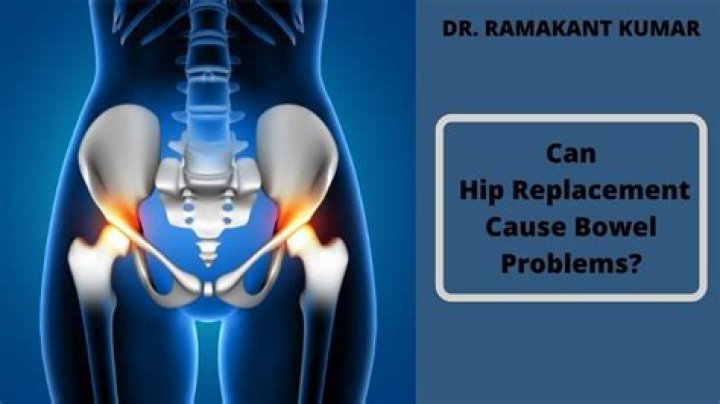 Can hip surgery cause bowel problems?